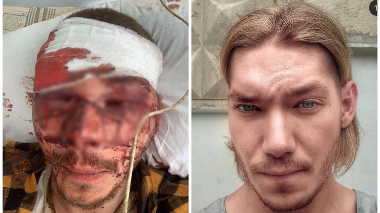 Никита Роженко накануне нападения жаловался в полицию на угрозы